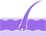 植發(fā)